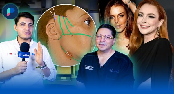 Estos son secretos de belleza para rejuvenecer: Dr. Rafael Espinosa de Hospital San José