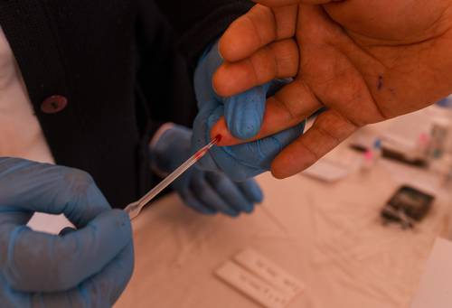 Más de la mitad de casos de cáncer de próstata se diagnostican tarde