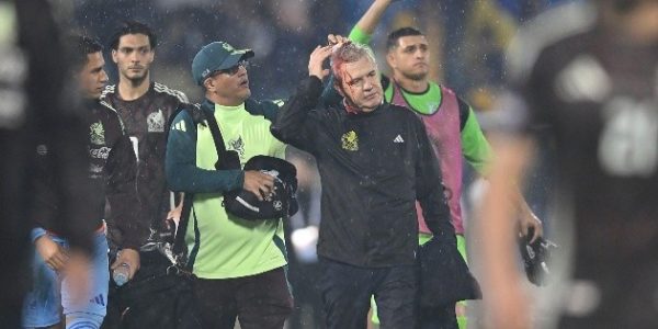 ¡Qué dolor! Así fue el momento en que descalabraron al "Vasco" Aguirre