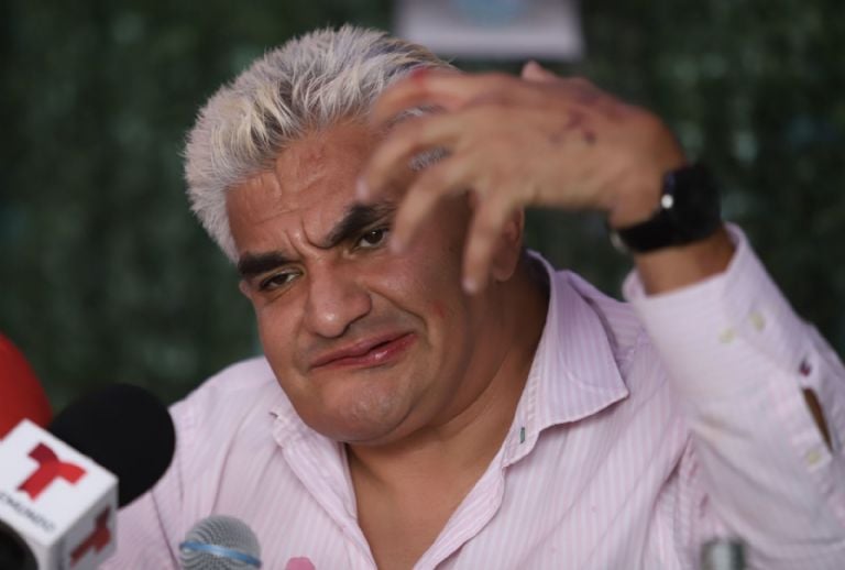 ¿Shocker está desaparecido? Esto es lo que sabemos del luchador mexicano