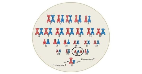 Científicos descubren un posible tratamiento para eliminar el Síndrome de Down mediante edición genética