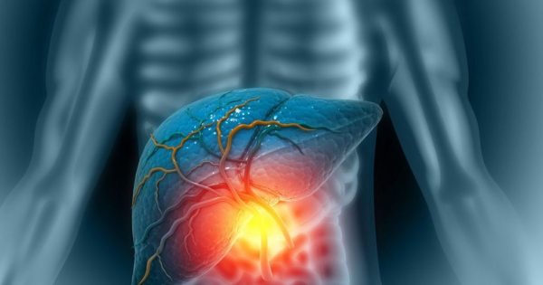 Hígado graso: estos son los síntomas para identificar a tiempo esta enfermedad