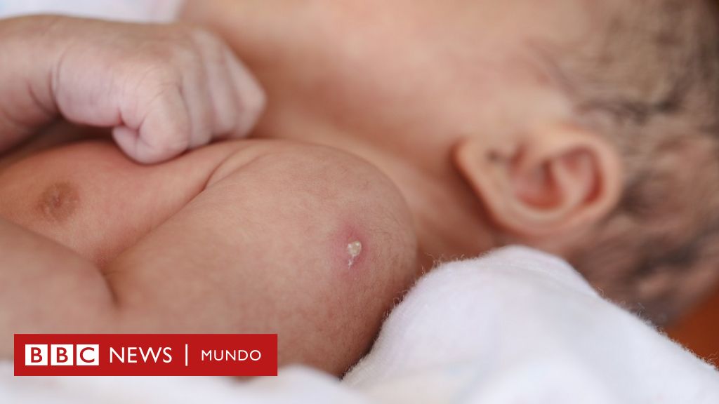 Impactos en la salud de recién nacidos por quema de gas