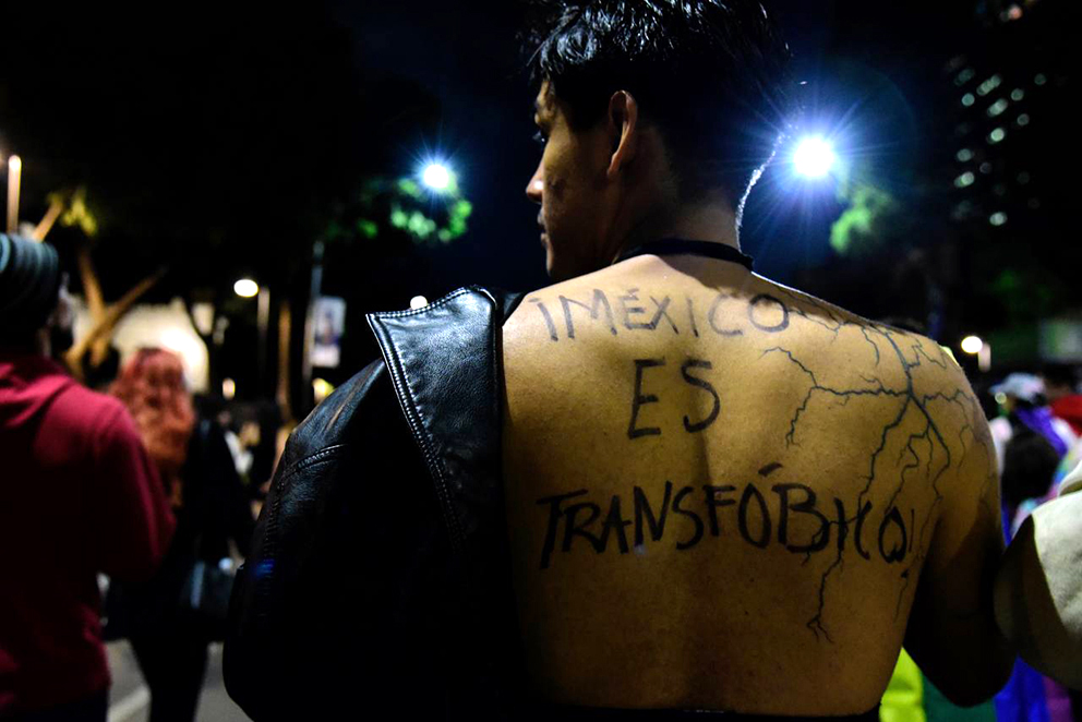 IMSS niega cirugía a mujer trans en Colima