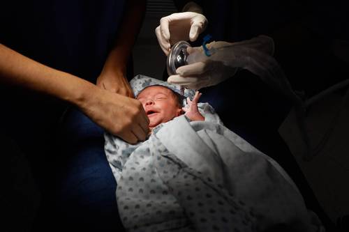 En Cholula, uno de 3 equipos para salvar la visión de recién nacidos