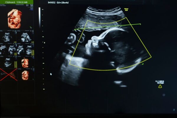 Los bebés antes de nacer están expuestos a “químicos eternos” y es peor de lo que pensábamos