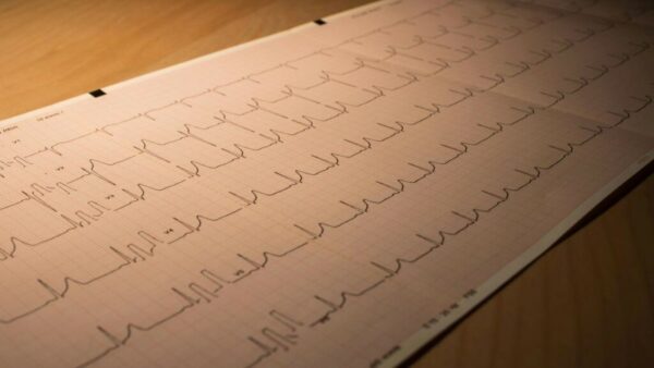 Inyección podría ayudar al corazón a recuperarse después de un infarto