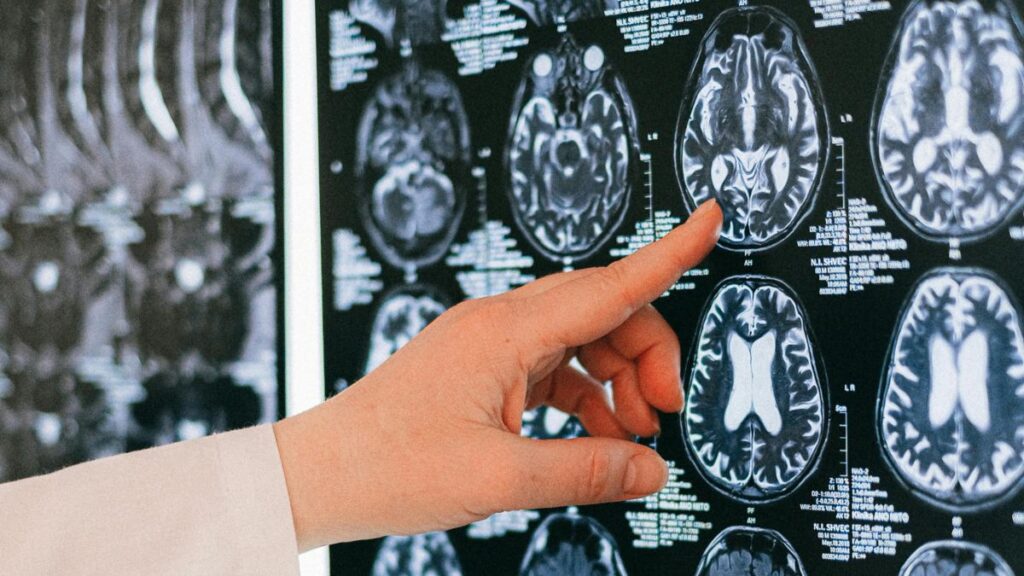 Chip cerebral contra la depresión