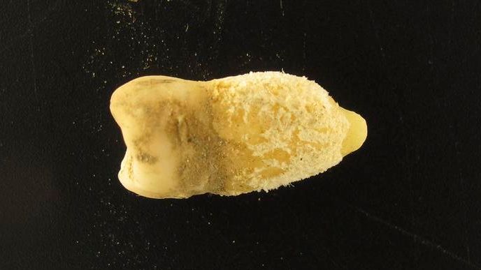 Una momia boliviana reescribe toda la historia de la escarlatina en América