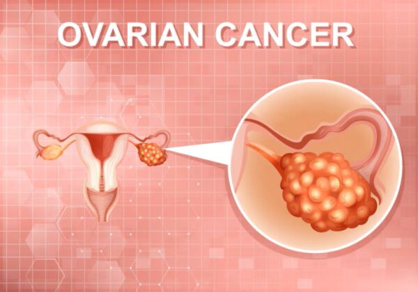 Presentan plan contra cáncer de ovario