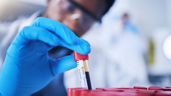 Este análisis de sangre promete revelar la edad biológica de tus órganos por separado