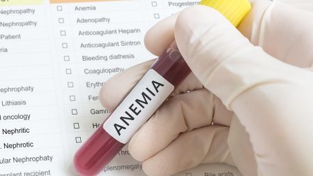 Anemia en adultos mayores, señal que no debe ignorarse - Ilustración 1